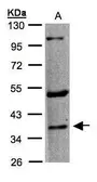 Anti-5-HT1F receptor antibody [C2C3], C-term used in Western Blot (WB). GTX100321