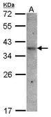 Anti-GPR164 antibody [N2C1], Internal used in Western Blot (WB). GTX100361