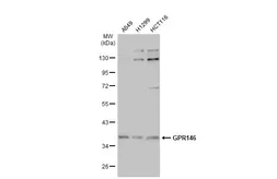 Anti-GPR146 antibody [C1C2], Internal used in Western Blot (WB). GTX100365