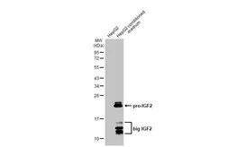 Anti-IGF2 antibody [N1C3] used in Western Blot (WB). GTX100453