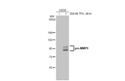 抗-MMP9抗体[N2C1]，内部用于蛋白质印迹（WB）。GTX100458型