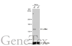 Anti-c-Met antibody [C3], C-term used in Western Blot (WB). GTX100637
