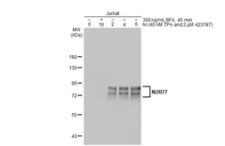 Anti-NUR77 antibody used in Western Blot (WB). GTX100797