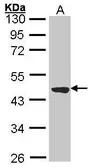 Anti-TTLL1 antibody [N1C3] used in Western Blot (WB). GTX100853