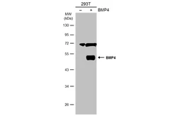 Anti-BMP4 antibody used in Western Blot (WB). GTX100875