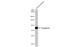Anti-Transferrin antibody [N3C3] used in Western Blot (WB). GTX101035
