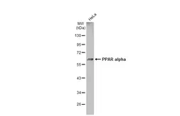 Anti-PPAR alpha antibody used in Western Blot (WB). GTX101098