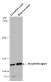 Anti-Insulin Receptor beta antibody used in Western Blot (WB). GTX101136