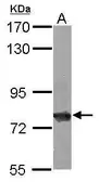 Anti-HSC70 antibody used in Western Blot (WB). GTX101144