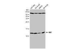 Anti-MIF antibody [N1C3] used in Western Blot (WB). GTX101162