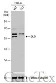 Anti-DLD antibody used in Western Blot (WB). GTX101245