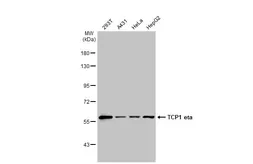 Anti-TCP1 eta antibody [C1C3] used in Western Blot (WB). GTX101347