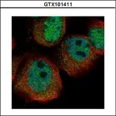 Anti-RPS27A antibody used in Immunocytochemistry/ Immunofluorescence (ICC/IF). GTX101411