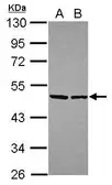 Anti-EIF4A2 antibody used in Western Blot (WB). GTX101484