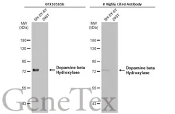 Anti-Dopamine beta Hydroxylase antibody used in Western Blot (WB). GTX101616