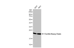Anti-Ferritin Heavy Chain antibody [N1C3] used in Western Blot (WB). GTX101733