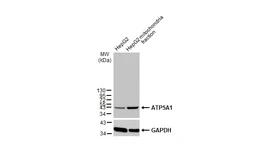 Anti-ATP5A1 antibody [C2C3], C-term used in Western Blot (WB). GTX101741