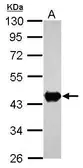 Anti-Creatine kinase (brain) antibody [N1C1] used in Western Blot (WB). GTX101759