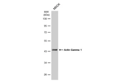 Anti-Actin Gamma 1 antibody used in Western Blot (WB). GTX101794