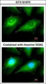 Anti-OTUB1 antibody [N1C1] used in Immunocytochemistry/ Immunofluorescence (ICC/IF). GTX101973