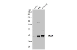 Anti-MCL1 antibody used in Western Blot (WB). GTX102026