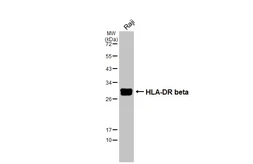 Anti-HLA-DR beta antibody [N1C3] used in Western Blot (WB). GTX102047