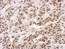 Anti-PUF60 antibody used in IHC (Paraffin sections) (IHC-P). GTX102051