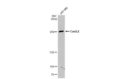 Anti-Cav2.2 antibody [C3], C-term used in Western Blot (WB). GTX102449