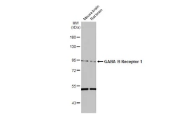 Anti-GABA B Receptor 1 antibody [N2C1], Internal used in Western Blot (WB). GTX102511