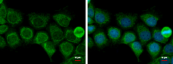 Anti-ACAT1 antibody [N1N3] used in Immunocytochemistry/ Immunofluorescence (ICC/IF). GTX102637