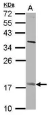 Anti-GS2 antibody used in Western Blot (WB). GTX102734