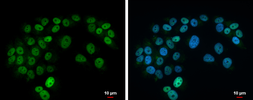 Anti-Islet 1 antibody used in Immunocytochemistry/ Immunofluorescence (ICC/IF). GTX102807