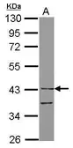 Anti-LILRA4 antibody [N3C3] used in Western Blot (WB). GTX103103