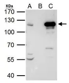 Anti-STAT2 antibody [C2C3], C-term used in Immunoprecipitation (IP). GTX103117