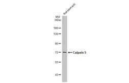 Anti-Calpain 5 antibody [N1C1] used in Western Blot (WB). GTX103264