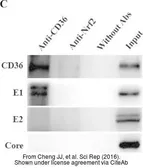 Anti-Hepatitis C virus E2 protein antibody used in Western Blot (WB). GTX103353