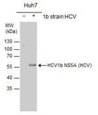 Anti-Hepatitis C virus NS5A protein antibody used in Western Blot (WB). GTX103358