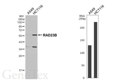 Anti-RAD23B antibody used in Western Blot (WB). GTX103424