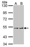 Anti-CYP4A11 antibody [N1C1] used in Western Blot (WB). GTX103518