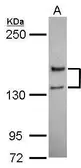 Anti-NMDAR2A antibody used in Western Blot (WB). GTX103558