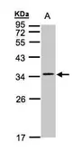 Anti-Cav gamma 5 antibody used in Western Blot (WB). GTX103664