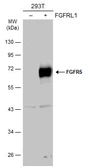 Anti-FGFR5 antibody used in Western Blot (WB). GTX103778