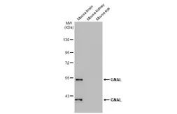 Anti-GNAL antibody used in Western Blot (WB). GTX103863