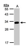 Anti-GILT antibody used in Western Blot (WB). GTX103967