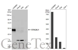Anti-ST6GAL1 antibody [N2C3] used in Western Blot (WB). GTX104018