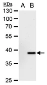 Anti-YKL-39 antibody [N1C3] used in Western Blot (WB). GTX104110
