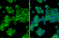 Anti-IL3 Receptor beta antibody [N1N3] used in Immunocytochemistry/ Immunofluorescence (ICC/IF). GTX104118