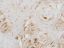 Anti-BCAT2 antibody used in IHC (Paraffin sections) (IHC-P). GTX104121