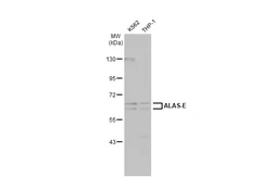 Anti-ALAS-E antibody [N3C3] used in Western Blot (WB). GTX104139