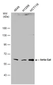 Anti-beta-Gal antibody [N2C3] used in Western Blot (WB). GTX104360